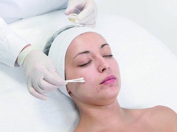 Шаг 3. Peelosophy Basic Rejuvenator Шаг 3. Peelosophy Basic Rejuvenator