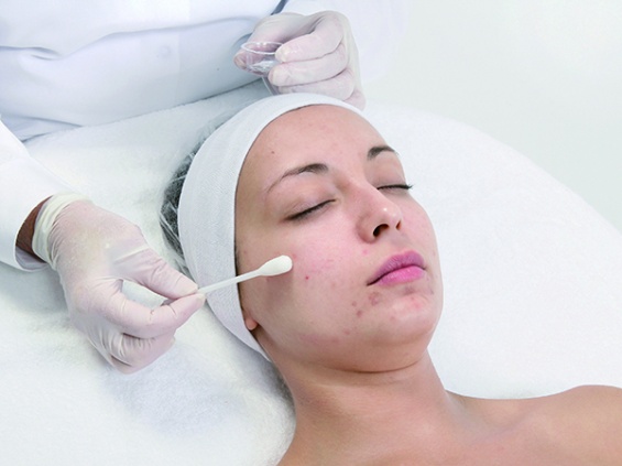 Шаг 5а. Peelosophy Acne Advanced Peel Шаг 5а. Peelosophy Acne Advanced Peel