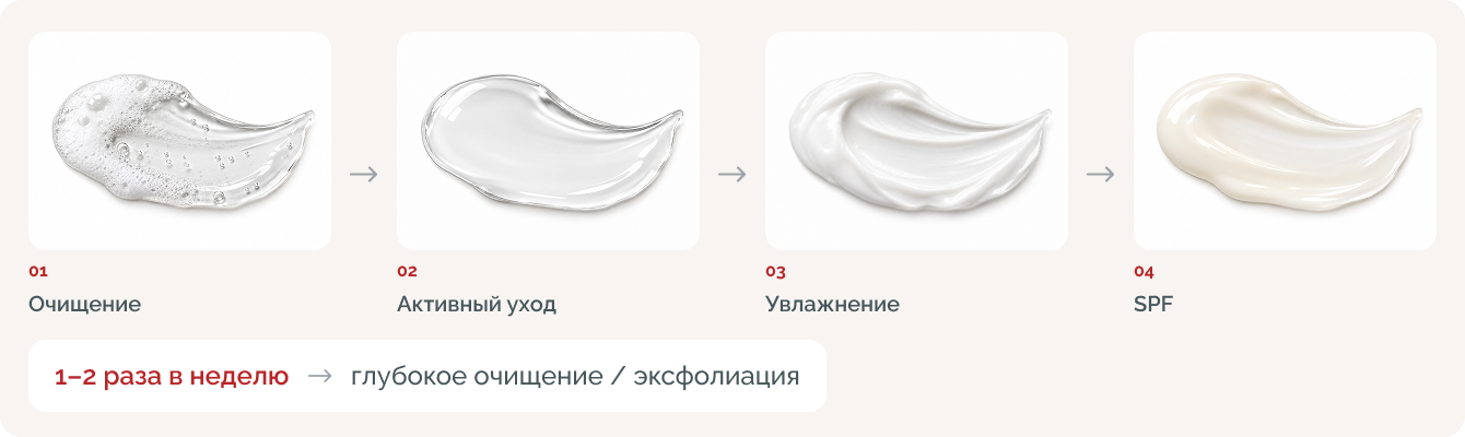 Можно ли выдавливать комедоны дома