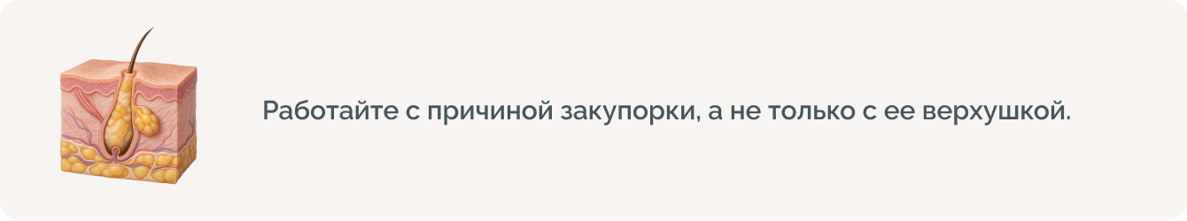 Можно ли выдавливать комедоны дома